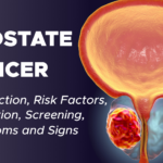 Causes and Symptoms of Prostate Cancer.